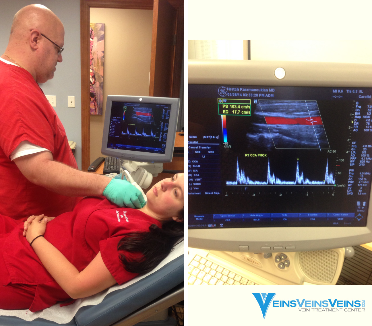Carotid Doppler Ultrasound for Carotid Artery Stenosis Carotid Doppler Ultrasound for Carotid Artery Stenosis