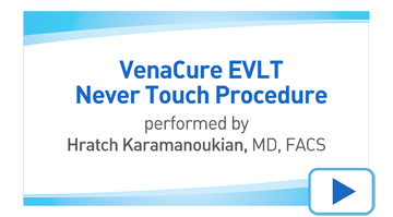 EVLT Never Touch Procedure