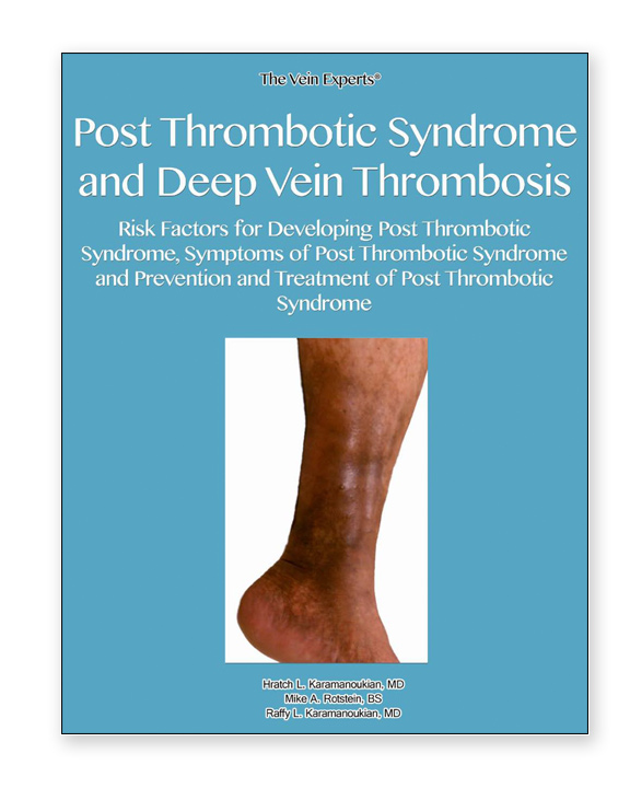 Post Thrombotic Syndrome and Deep Vein Thrombosis Post Thrombotic Syndrome and Deep Vein Thrombosis